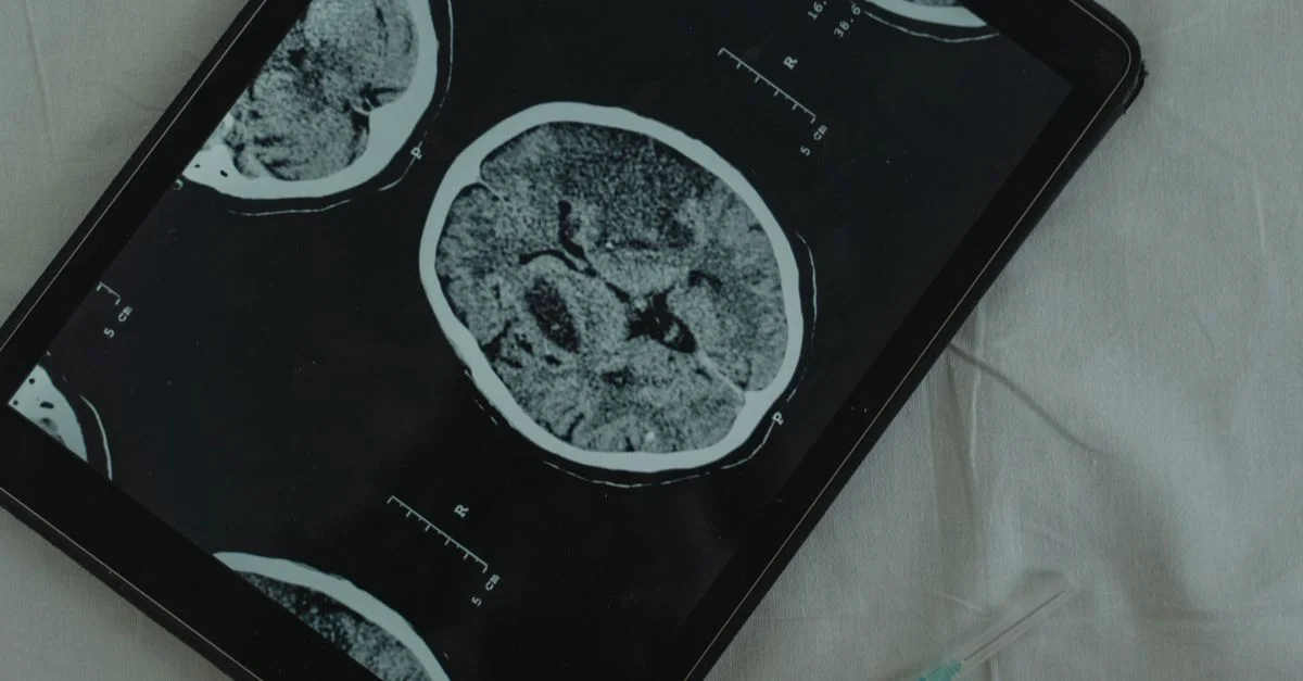 Vue rapprochée d'un scanner CT du cerveau affiché sur une tablette numérique avec une aiguille médicale à côté.